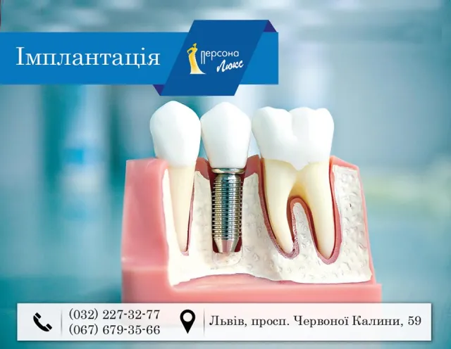 Стоматологічна клініка  «Персона люкс» — фото 4